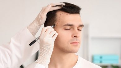 the-evolution-of-hair-transplant-technology-in-the-uk:-advancements-and-affordability