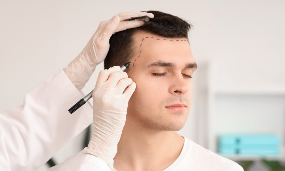 the-evolution-of-hair-transplant-technology-in-the-uk:-advancements-and-affordability